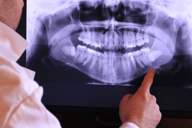 Best Knocked-Out Tooth Emergency  in Bryant, WA