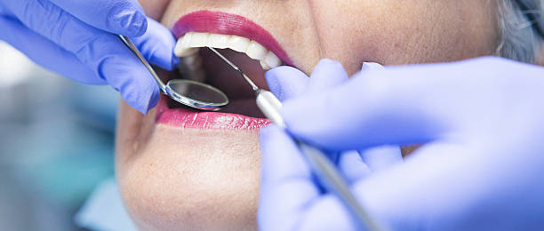 Best Chipped Tooth Repair Near Me  in Bryant, WA